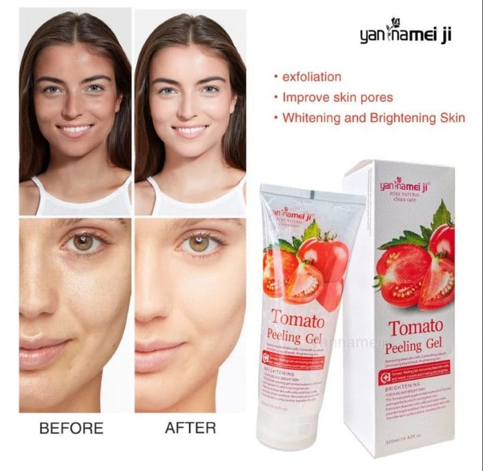 Yan Namei JI Tomato Peeling Gel